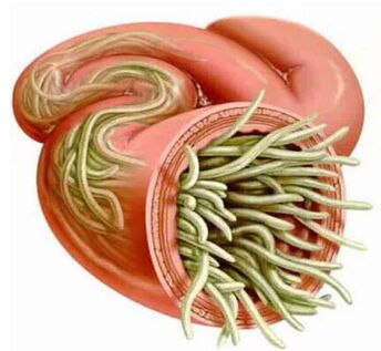 Symptoms and treatment of human parasites