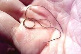 The parasite in the palm of your hand