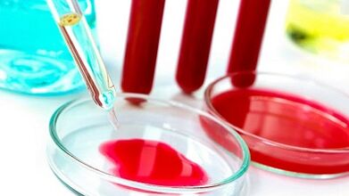 Blood test for parasites